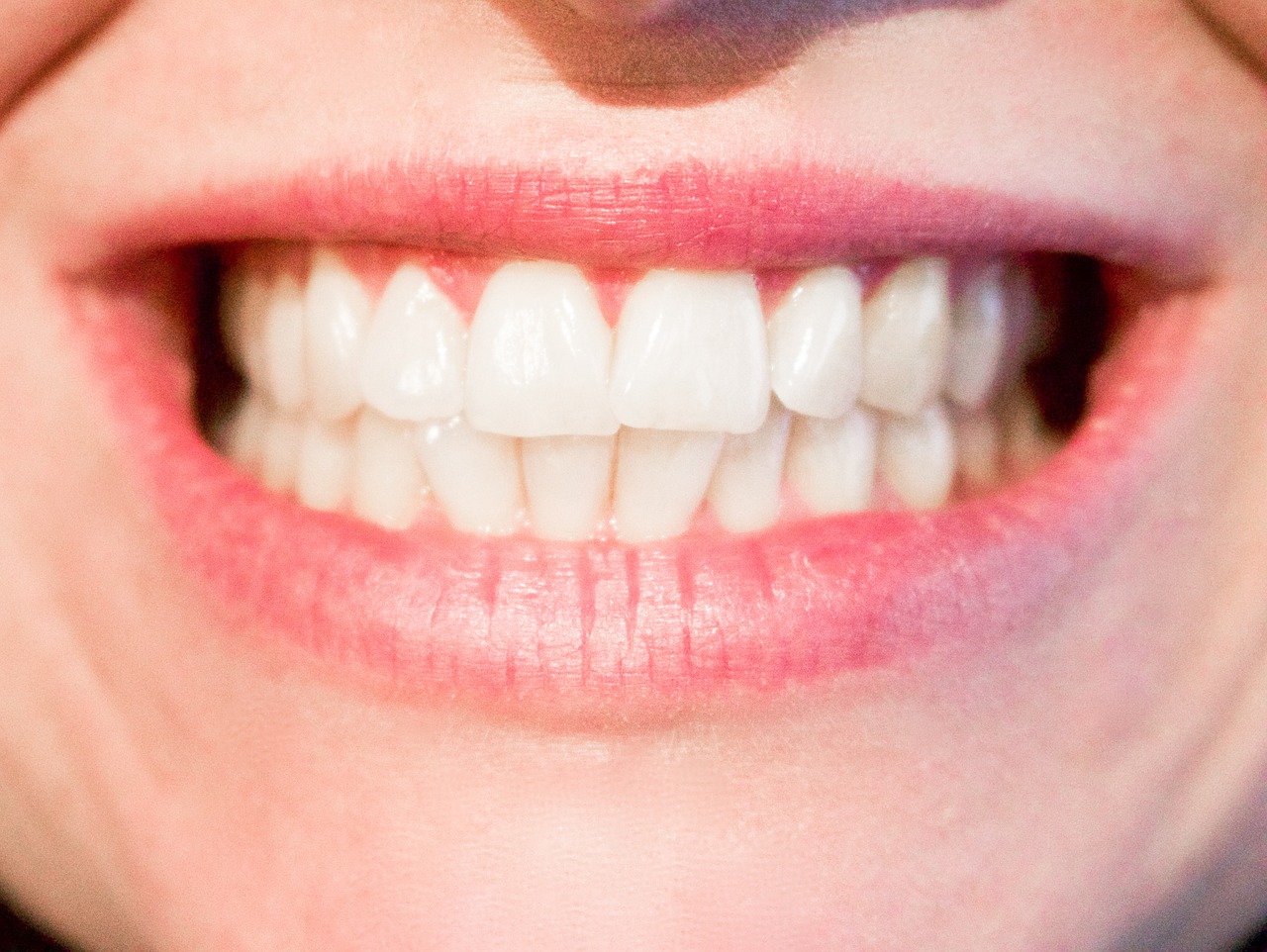 Keeping Your Dental Health in Check